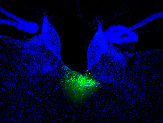 荧光标记的丘脑室旁核(pvt)(分离图) 论文作者供图