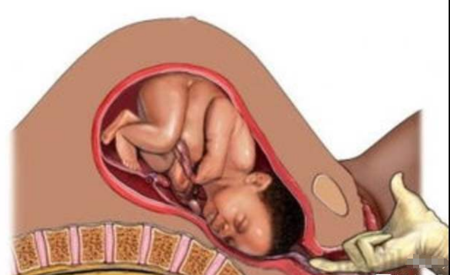 生宝宝的过程 顺产图片