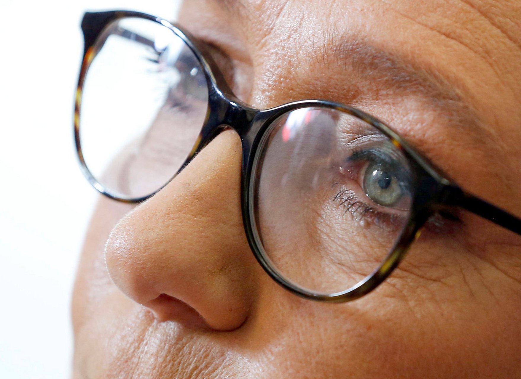 戴眼镜让眼睛变凸,这其实是一种误解.