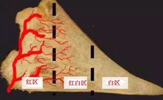 半月板的红区,白区,红白区,你搞懂了吗?