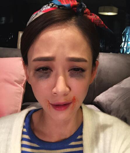 明星黑历史:谢娜上节目忘穿裤子,钢铁直男张一山跳舞