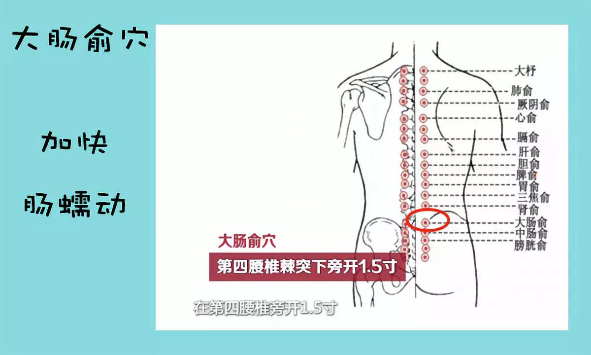 腰肌劳损艾灸哪些穴位调理?