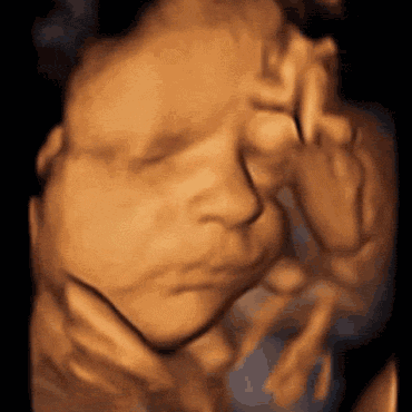 22周胎儿在腹中图片图片