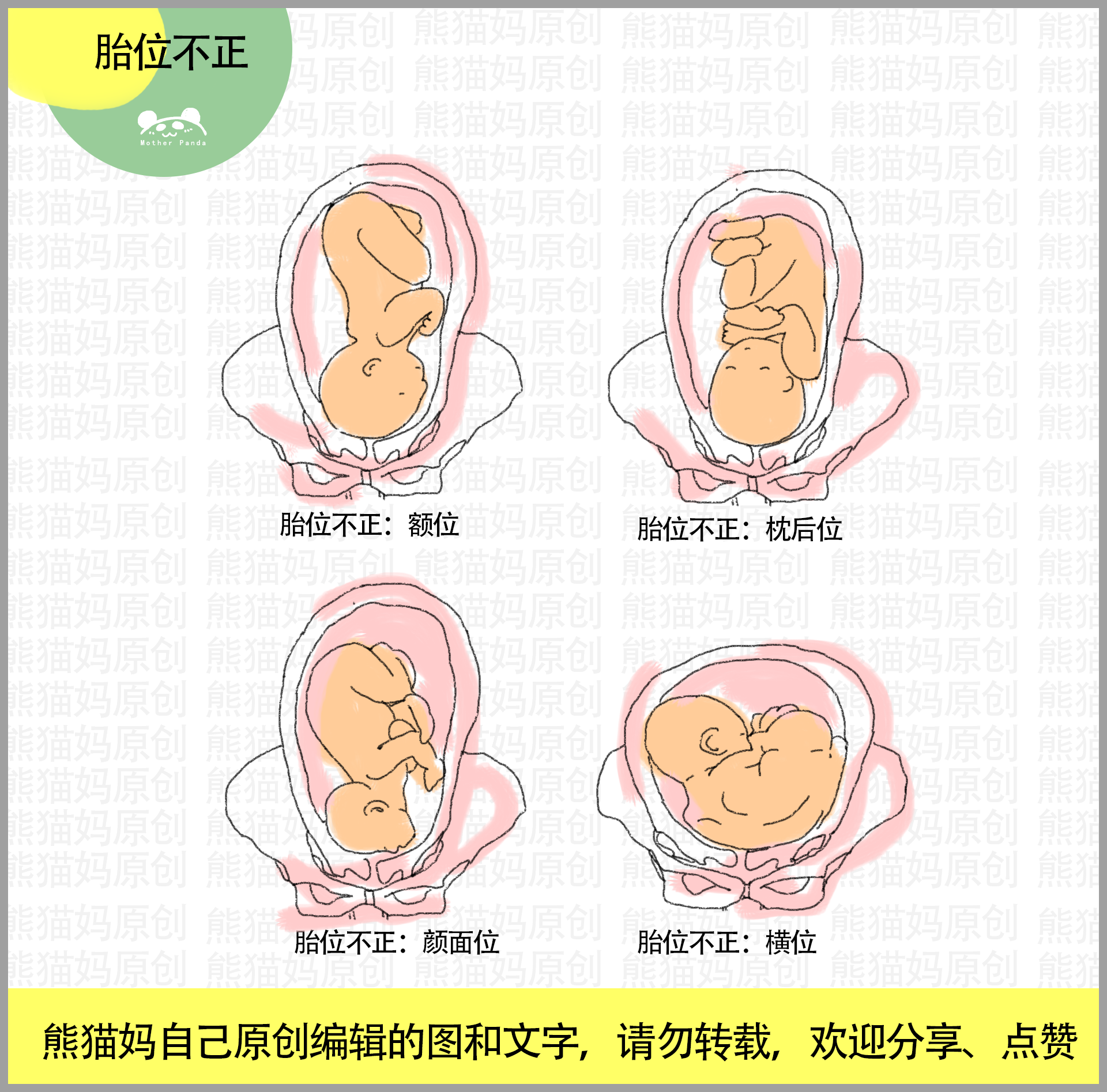 孕期5不利胎儿入盆:忌坐,骨盆狭窄,腹部肌肉结实,产后