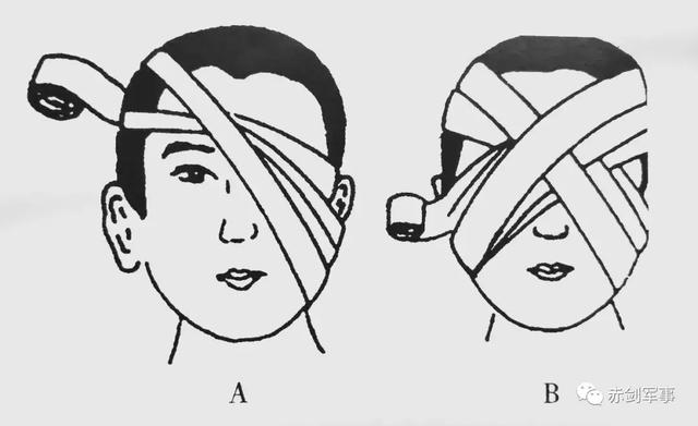 单眼绷带包扎法步骤图片
