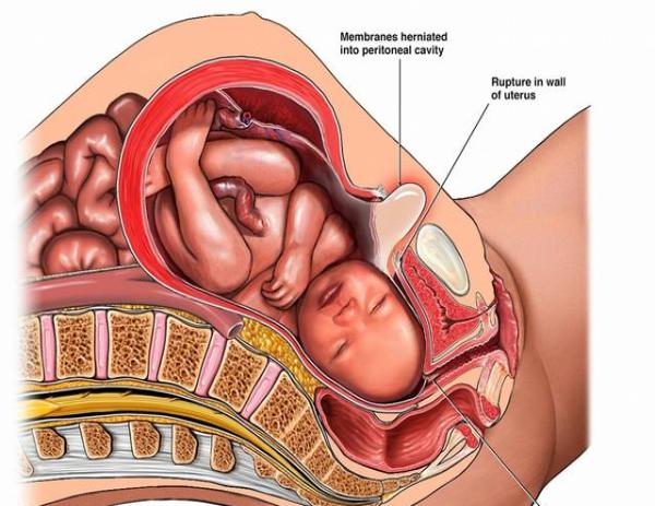 peritoneal cavity图片