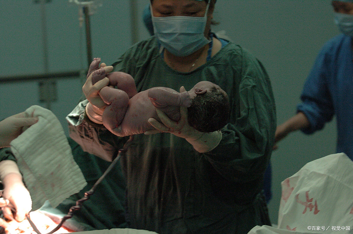 给新生儿剪脐带,是妈妈疼还是宝宝疼?正确护理很重要