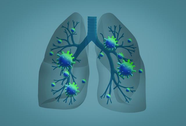 新型冠状病毒感染,会出现哪些症状?来看看钟南山院士的最新研究