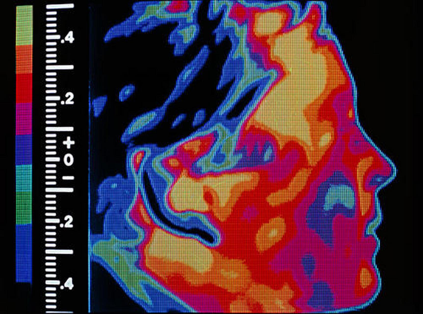 科普知识竞赛#辐射成像技术最早起源于1895年伦琴发现x光.