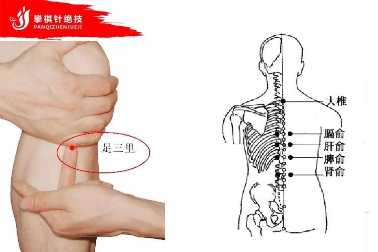 易针疗法示意图图片