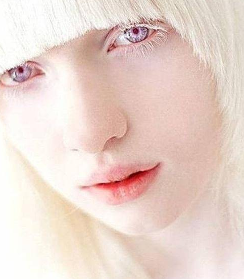 乌克兰最白的模特,自带紫色瞳孔,美丽背后的故事让人心疼!