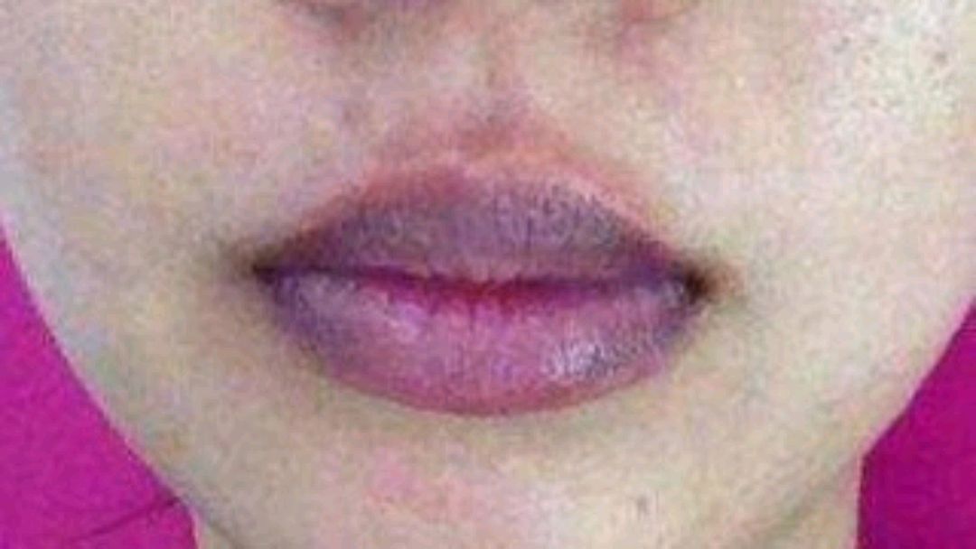 嘴唇外面一圈发紫图片
