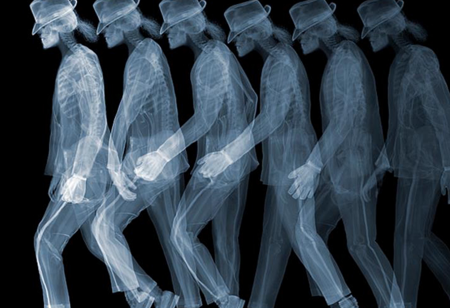 当你出现在x光镜头下会是什么样子?太恐怖了!(胆小的人勿进)