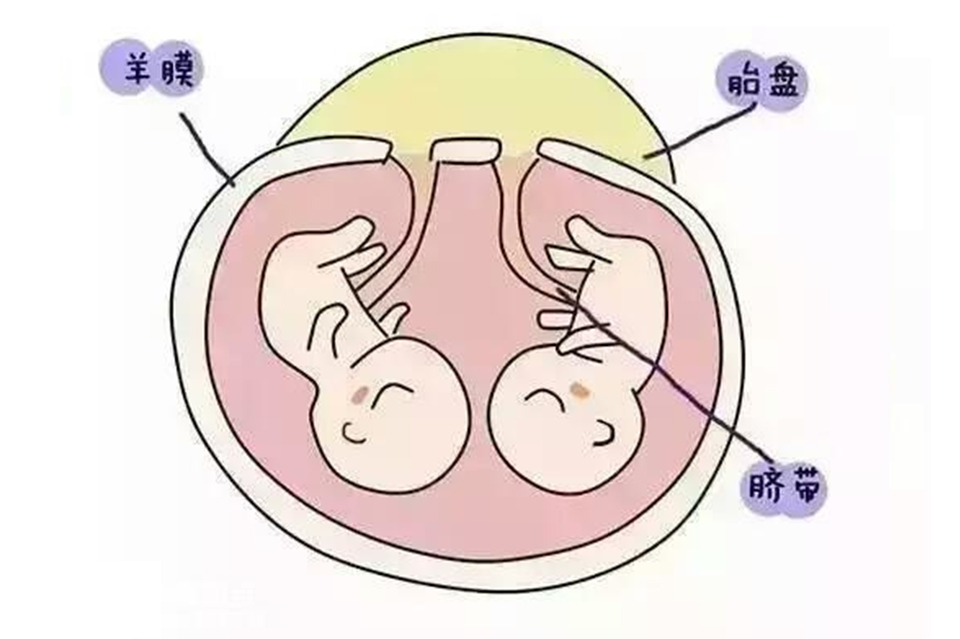 双胞胎在妈妈肚子里如何"居住"?看到他们抢占地盘,忍不住笑了