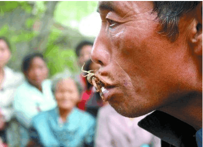 男子30年吃了一万多只蝎子,医生给他检查身体后,惊奇不已