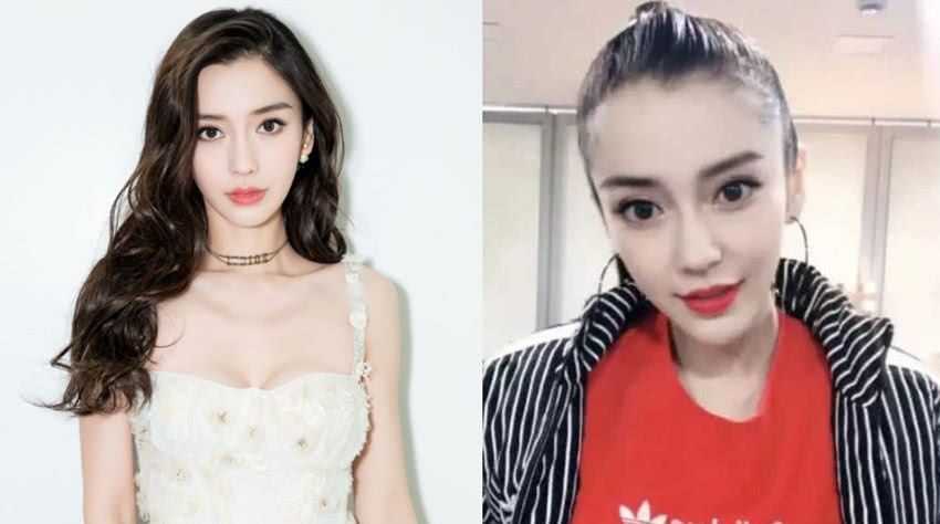 杨颖录视频发际线严重后移!"秃头"已成女明星们最大危机?