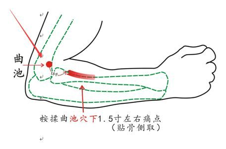 头晕反应迟钝艾灸哪些穴位?