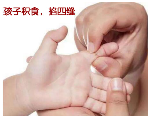 手指的十宣和四缝穴,日常生活离不了,急救,消积食就用到