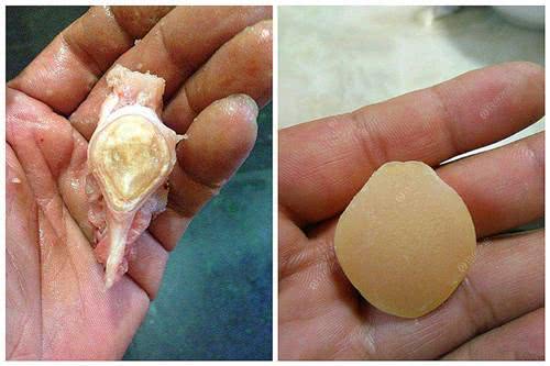 小孩戴防受惊的青鱼石真是从鱼里取得!宋代就有,客家