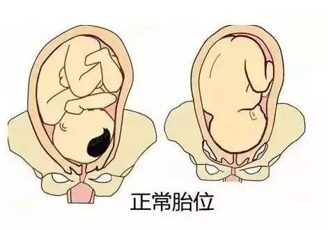 11,是loa,loa是左枕前胎位的缩写表示顶先露,胎儿枕骨在骨盆左侧,朝前