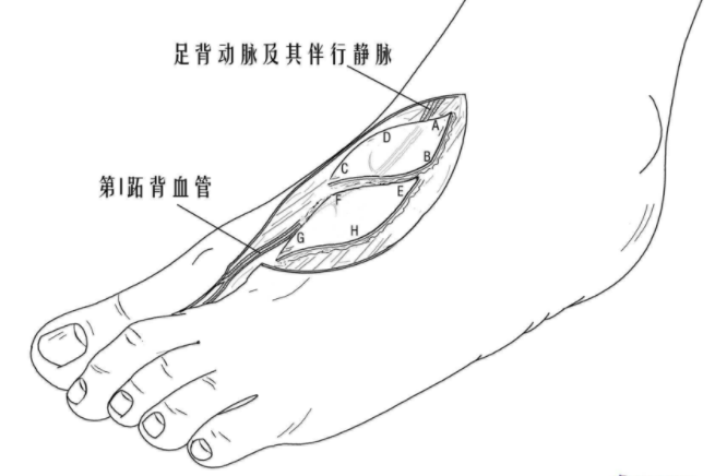 如果脚上有这四种表现,说明血管已经"堵塞",不可大意