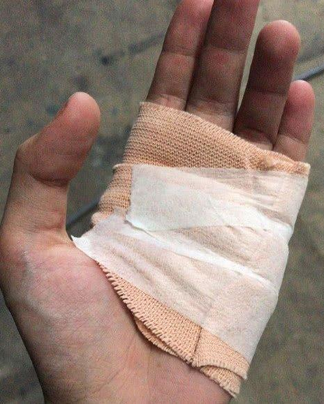 昆凌晒受伤照片,昆凌撒娇随意评论,周董当真实力宠妻