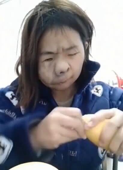女孩半张脸毁容变"丑八怪,得知她的老公孩子,这是真正的爱情