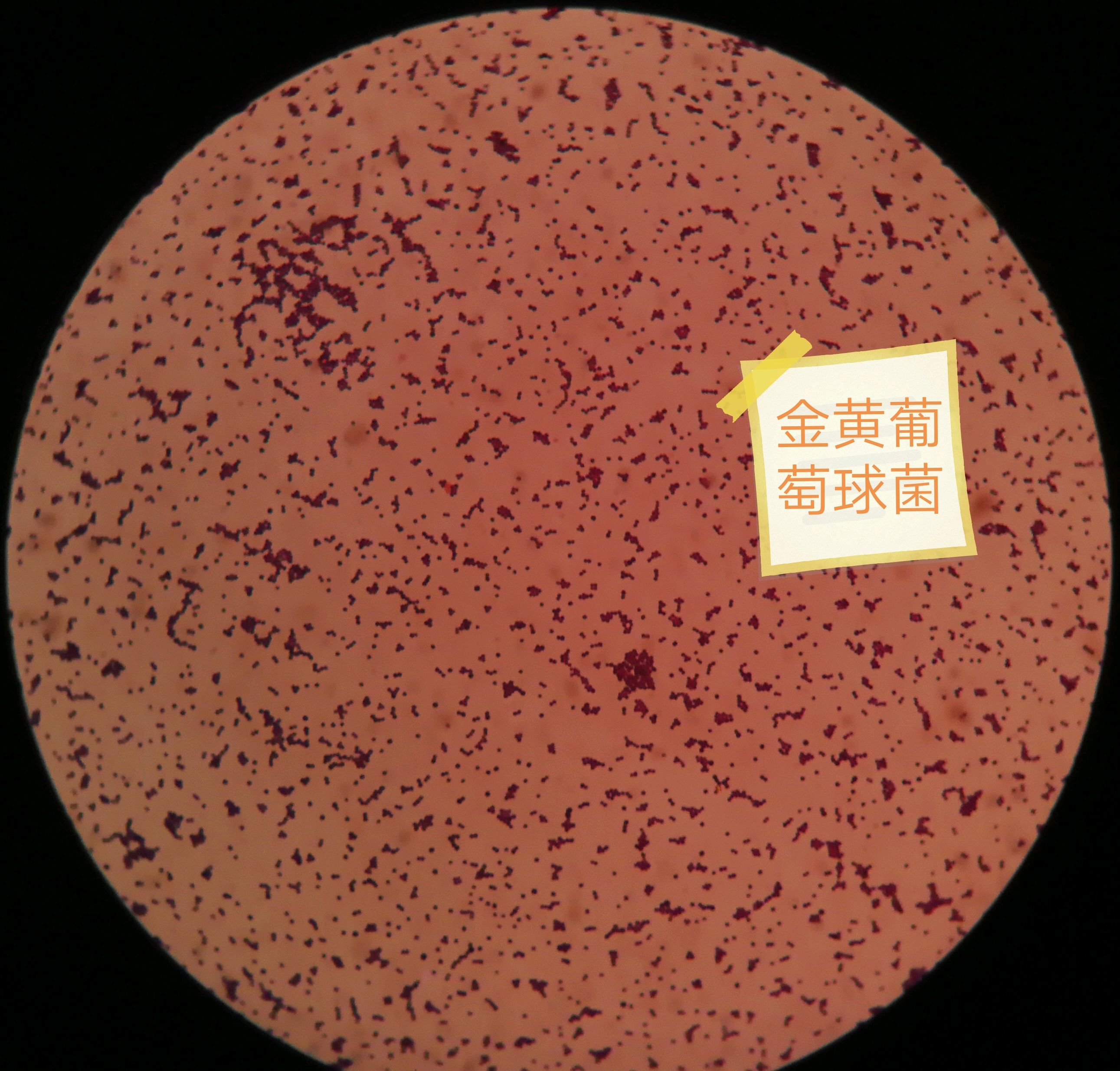 今天发现了两种细菌:表皮葡萄球菌和金黄葡萄球菌,分享一下.