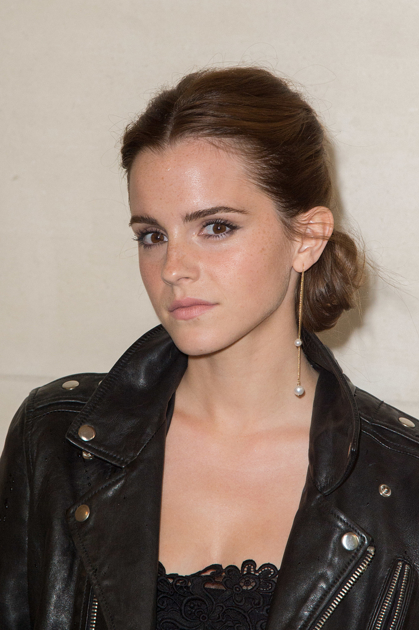 #娱乐风向# 发量堪忧!33岁艾玛·沃特森出街 素颜状态太憔悴!当地时间