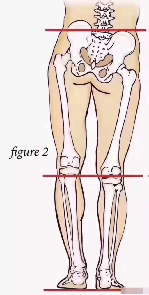 骨盆导致长短腿图片
