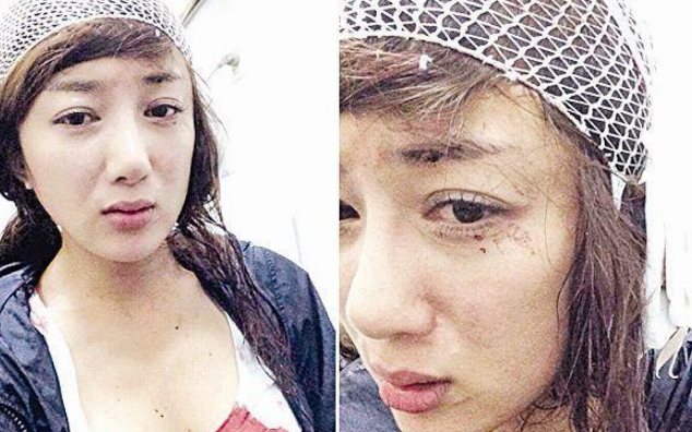 她曾被叶璇的狗咬伤,缝了20针后整容5次,没想到因《知否》火了