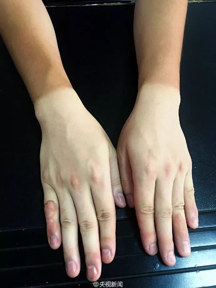 致敬!这才是世上最美的手!