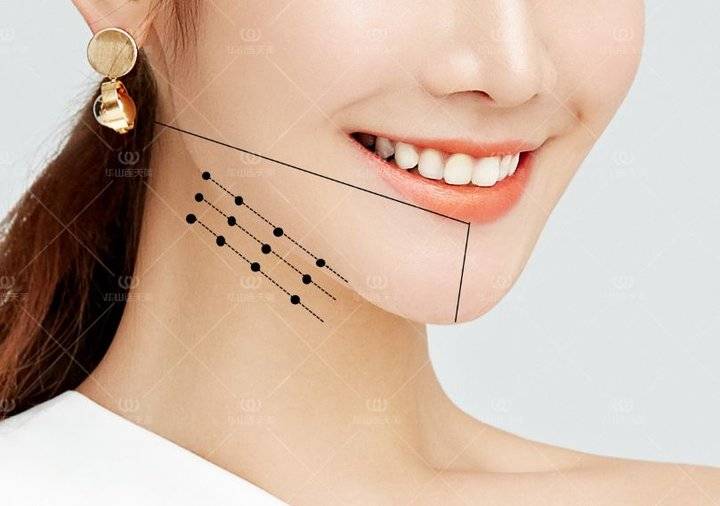 为什么你的"侧颜杀"一直不精致?问题全在这根"少女线"!