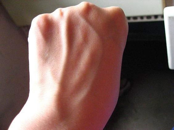 手上为什么会起"青筋"?跟身体状况有关吗?可能很多人都不清楚