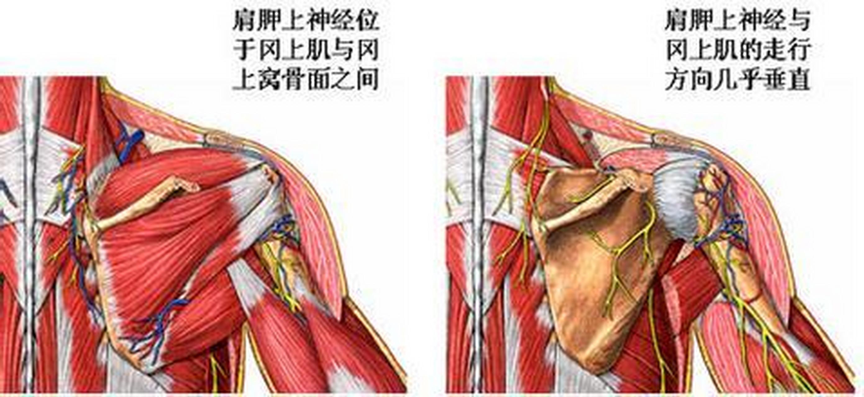 冈上肌肌腱断裂多因间接外力所致.因直接打击肩部造成者少见.