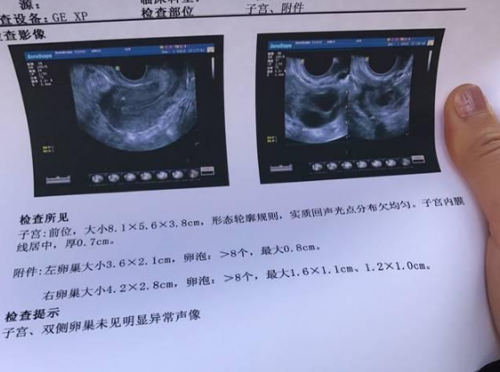 什么样的卵泡能排出好的卵子?可不是越大越好,备孕妈妈要这样做