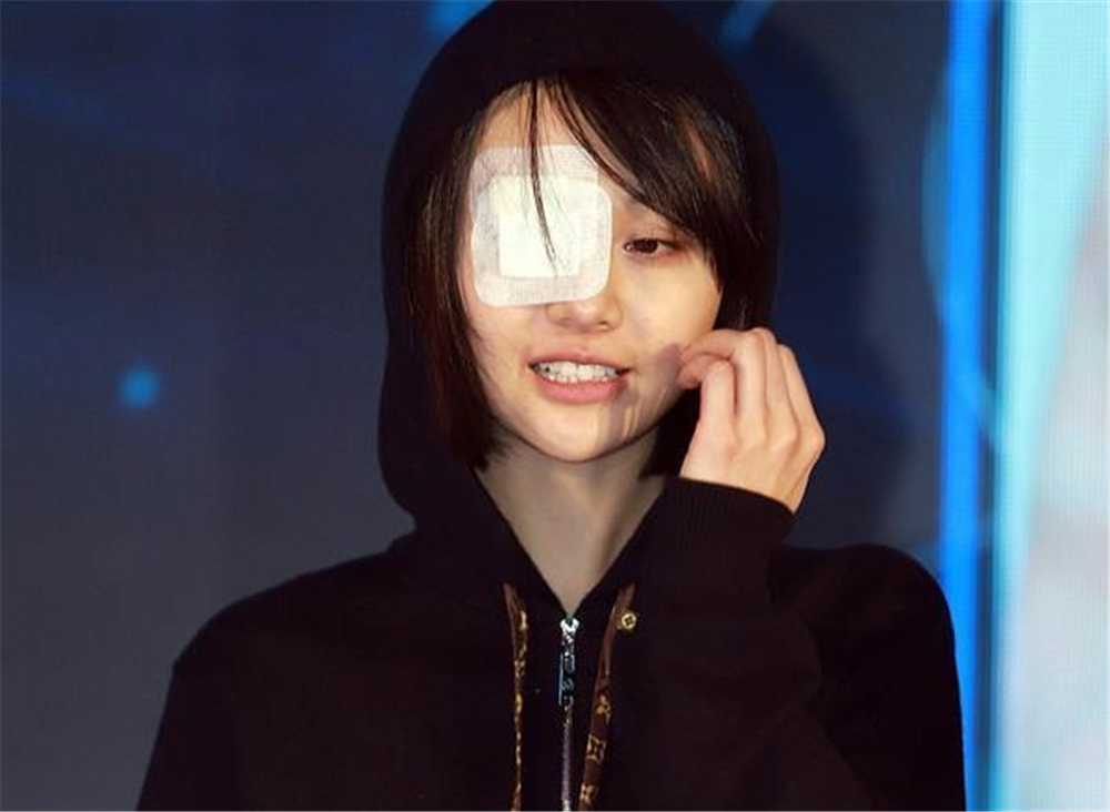 郑爽新年后首晒自拍,嘴角疤痕明显,新剧男主是泰国帅哥?