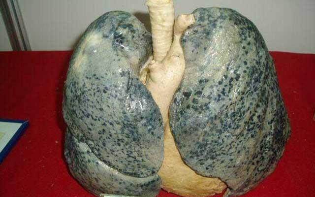 抽烟的肺恐怖图片