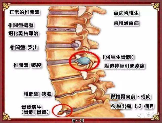 肋骨骨质增生图片图片