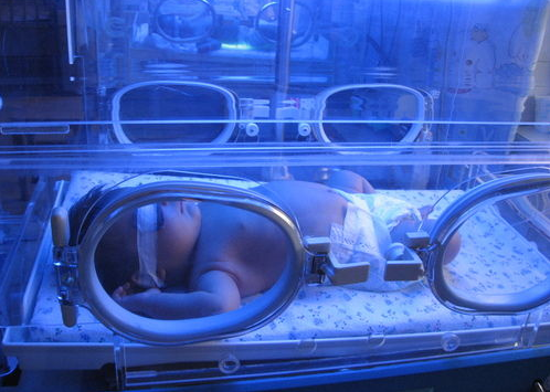 宝宝黄疸总偏高!医生说要蓝光治疗,新手爸妈真的懂吗?