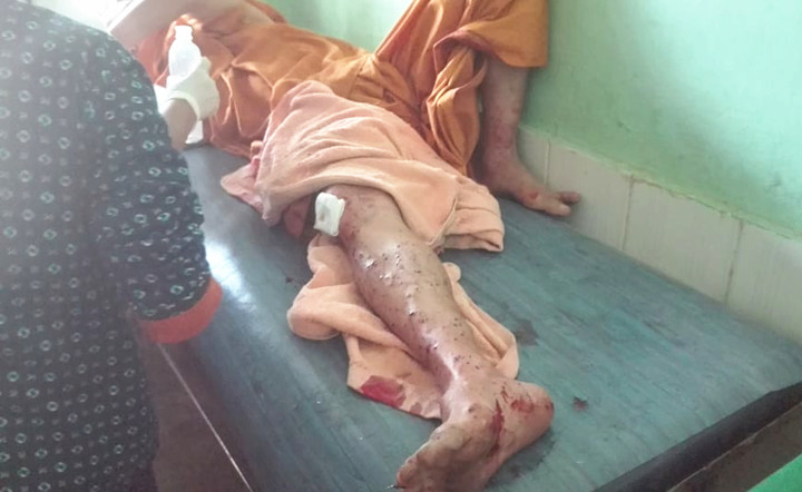 掸北3名和尚外出时误触地雷被炸伤 被炸地点曾是南掸邦军据点