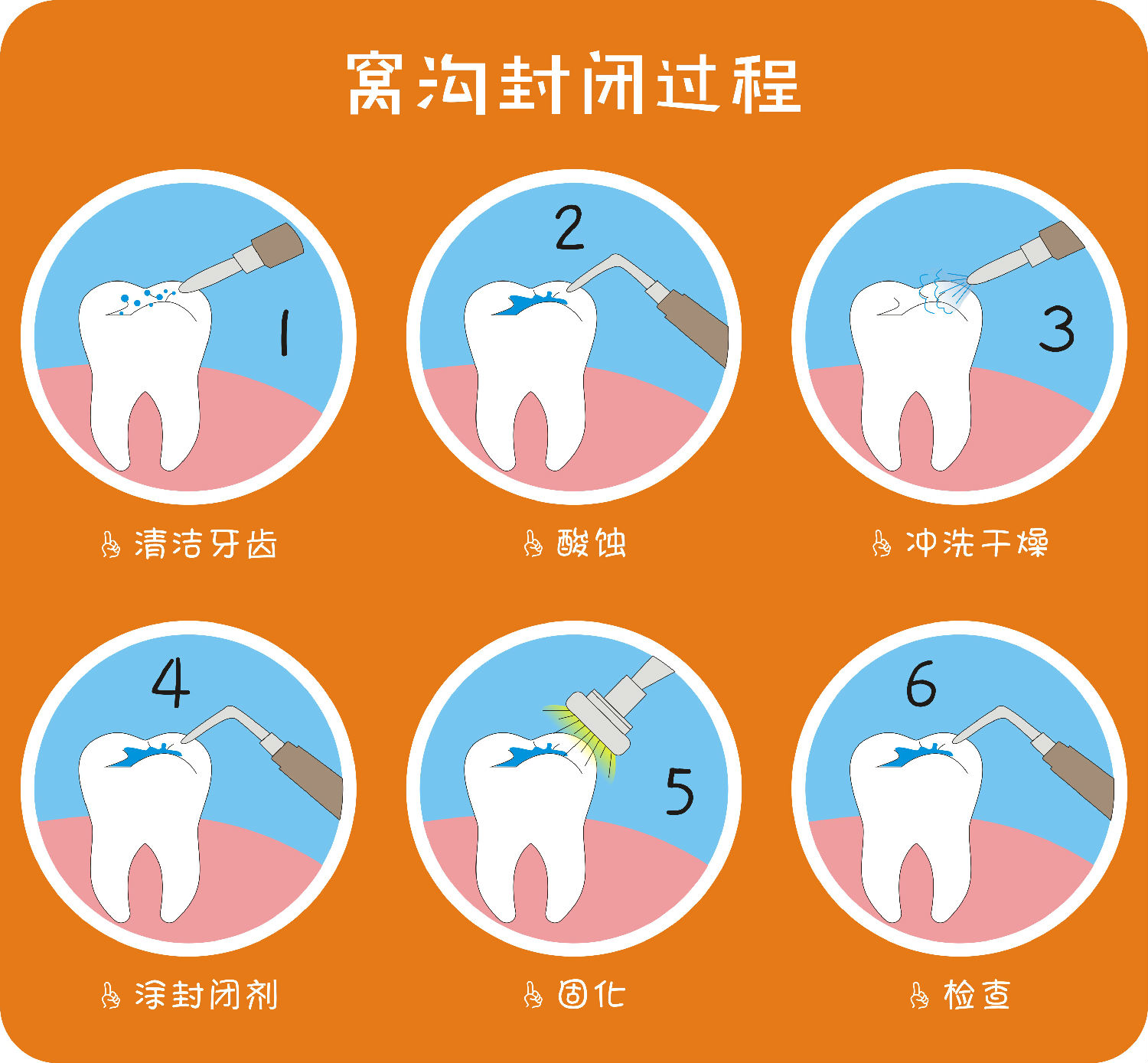 窝沟封闭手抄报二年级图片