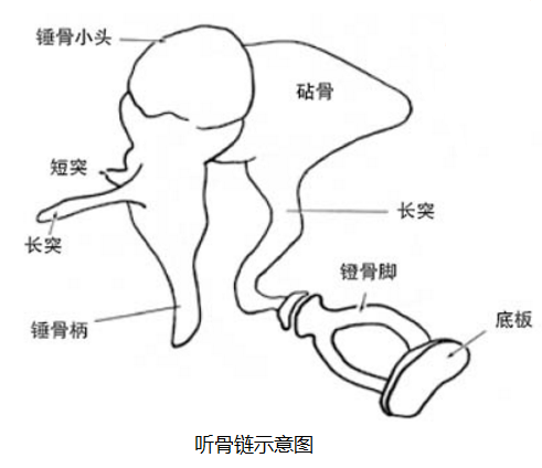 听小骨假体图片