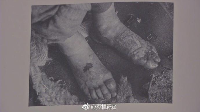 勿忘历史!又一支侵华日军细菌战部队名册被公开