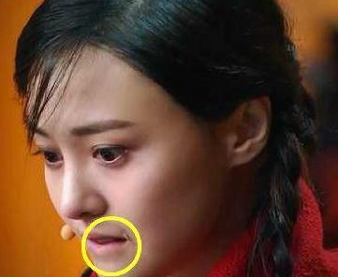 盘点脸上有"疤"的4位明星,郑爽上榜,最后一位网友:没想到!