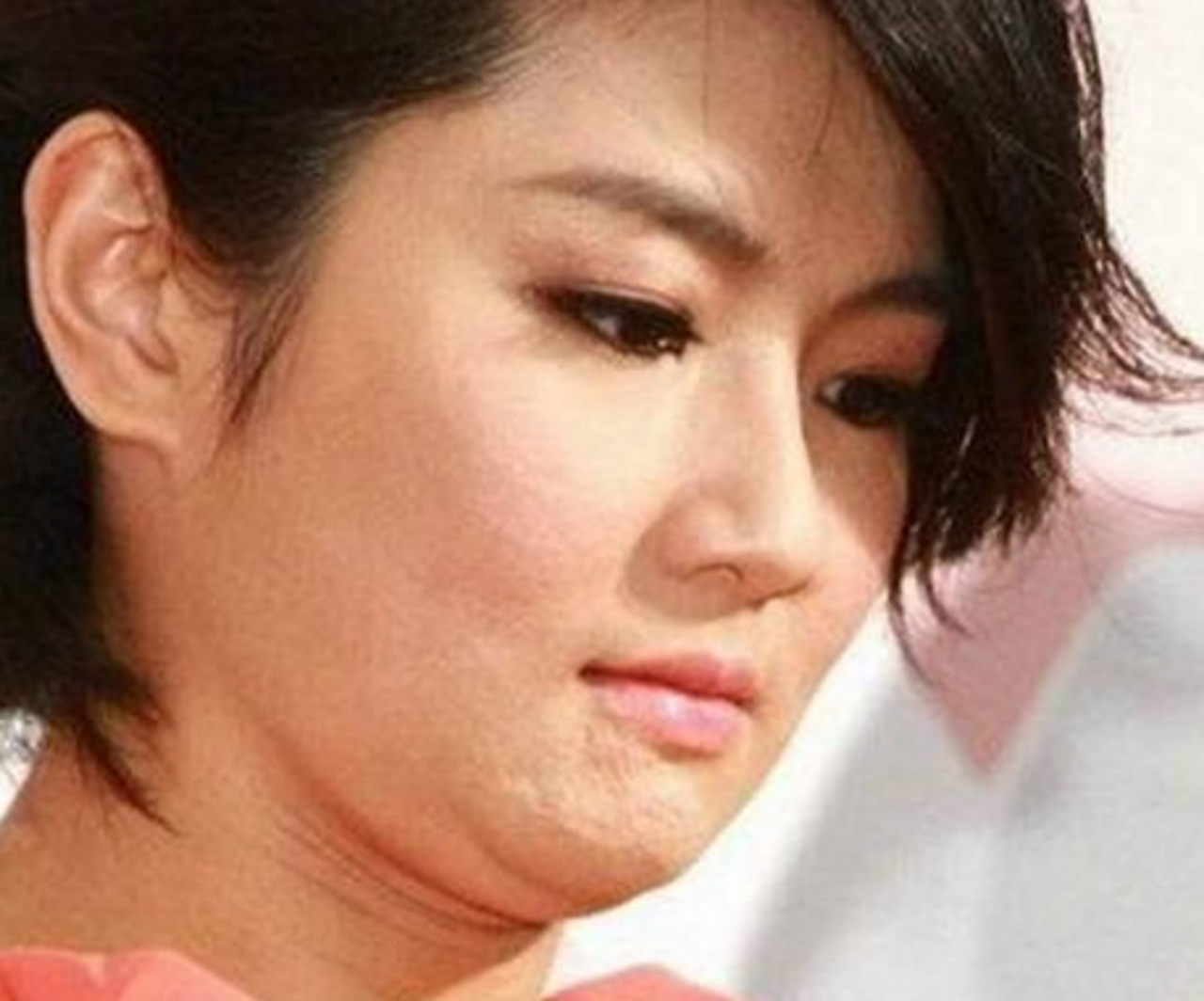 盘点脸上有"疤"的4位明星,郑爽上榜,最后一位网友:没想到!