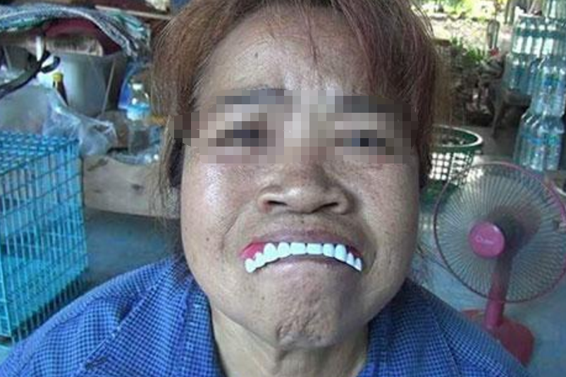 泰国大姐网购假牙,带上后瞬间变成"容嬷嬷",网友:笑掉大牙了