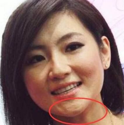 明星脸上的疤痕:胡歌帅气依旧,鹿晗变男子汉,她却很霸气!