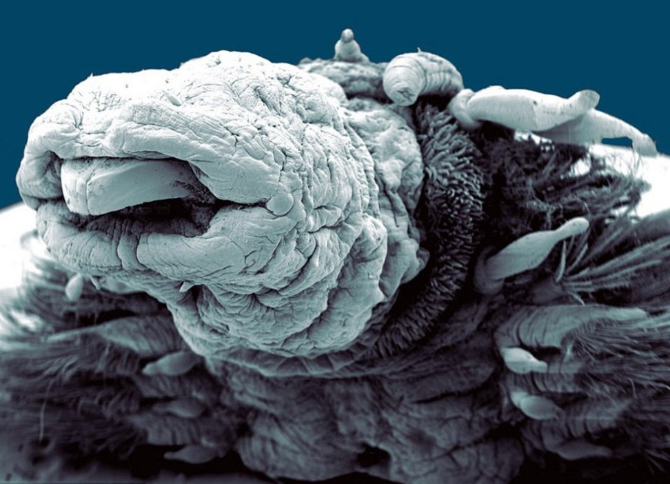 直击:显微镜下的世界,让人睁大了眼睛!有没有感觉到恐怖?