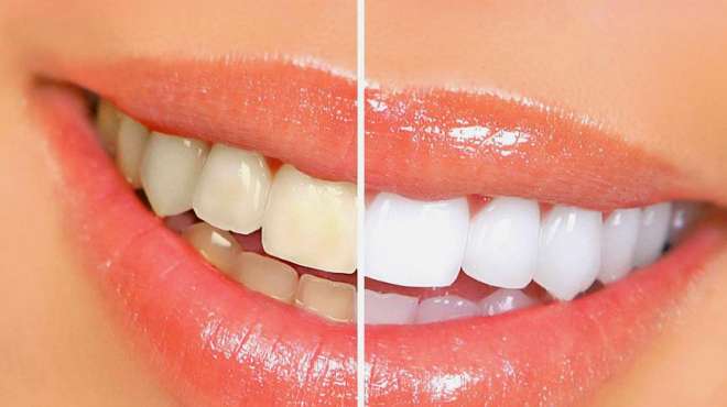 牙齿黄黑不要怕,不用花一分钱,让你的牙变得又白又干净!